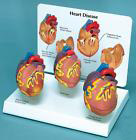 Heart Mini Set of 3 Anatomical Models